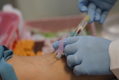 Cuba avanza un proyecto de vacuna terapéutica contra el VIH/SIDA 