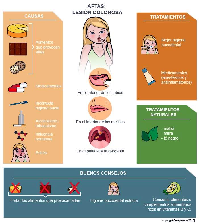 Las aftas bucales pueden no ser peligrosas, pero sí molestan