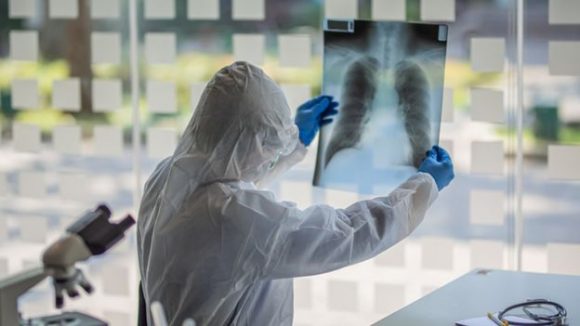 EL covid-19 compromete gravemente la salud de los pulmones en algunos pacientes.