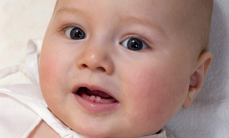 Todos necesitan conocer sobre los dientes de leche