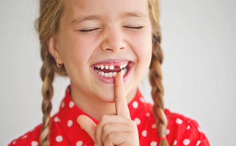 Todos necesitan conocer sobre los dientes de leche